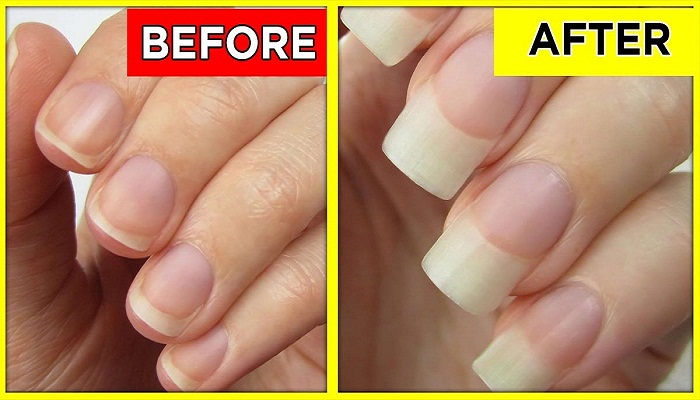 rubbing garlic on nails